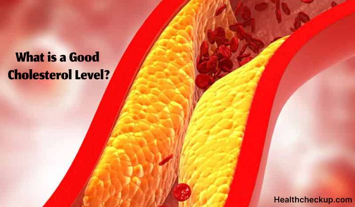What is a Good Cholesterol Level?