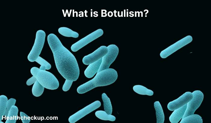 Botulism - Definition, Symptoms, Diagnosis, Treatment