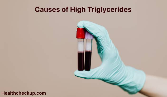 High Triglycerides Causes, Symptoms, Treatment