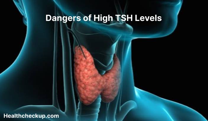 What is considered a dangerously high TSH Level?
