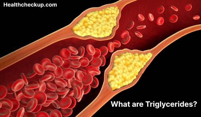 Triglycerides - High, Low, Normal Range