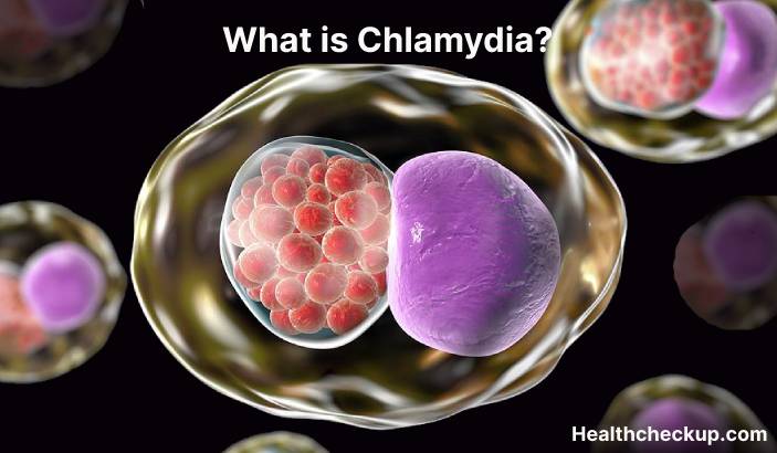 Chlamydia - Symptoms, Diagnosis, Treatment, Prevention