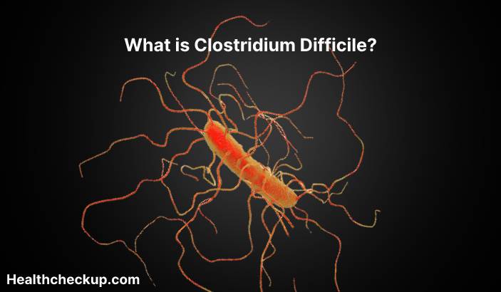 Clostridium difficile - Symptoms, Diagnosis, Treatment, Prevention