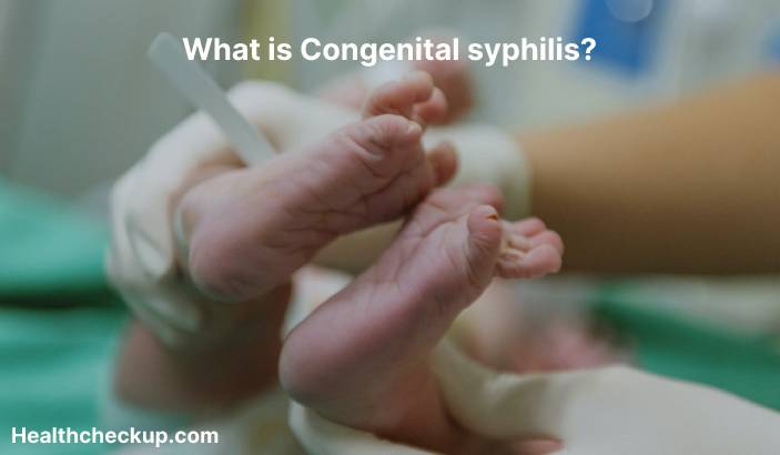 Congenital syphilis - Symptoms, Diagnosis, Treatment, Prevention