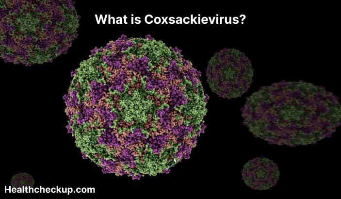 Coxsackievirus - Symptoms, Diagnosis, Treatment, Prevention