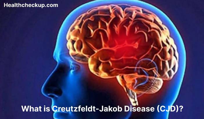 Creutzfeldt-Jakob disease (CJD) - Symptoms, Diagnosis, Treatment, Prevention