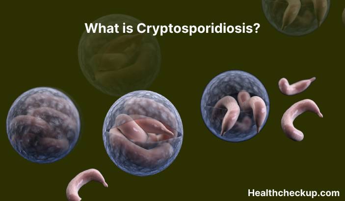 Cryptosporidiosis - Symptoms, Diagnosis, Treatment, Prevention