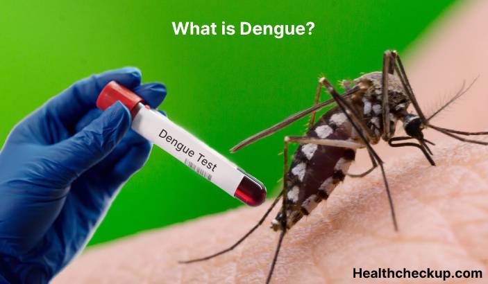 Dengue - Symptoms, Diagnosis, Treatment, Prevention