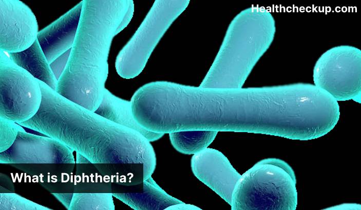 Diphtheria - Symptoms, Diagnosis, Treatment, Prevention