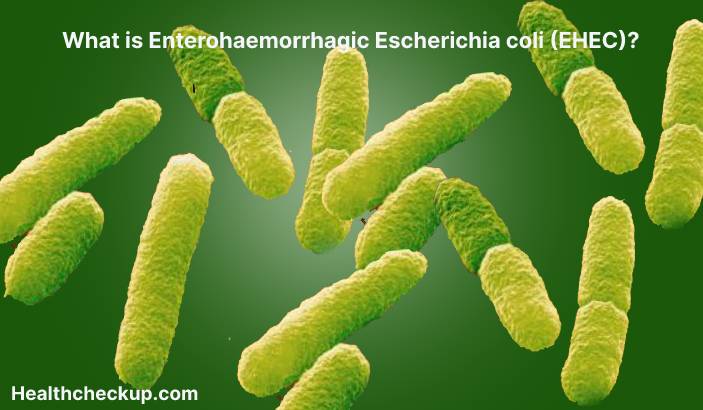 EHEC Infection - Symptoms, Diagnosis, Treatment, Prevention