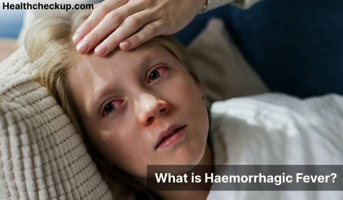 Haemorrhagic fever - Symptoms, Diagnosis, Treatment, Prevention