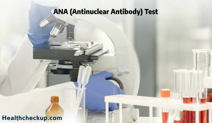 ANA (Antinuclear Antibody) Test: Purpose, Procedure, Results