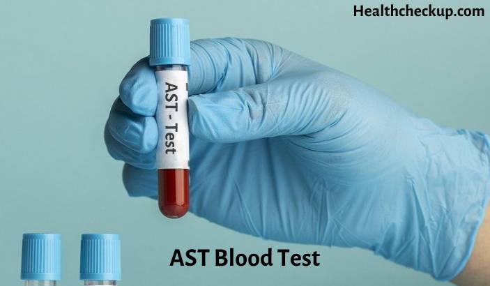 AST Blood Test: Low, High and Normal Range