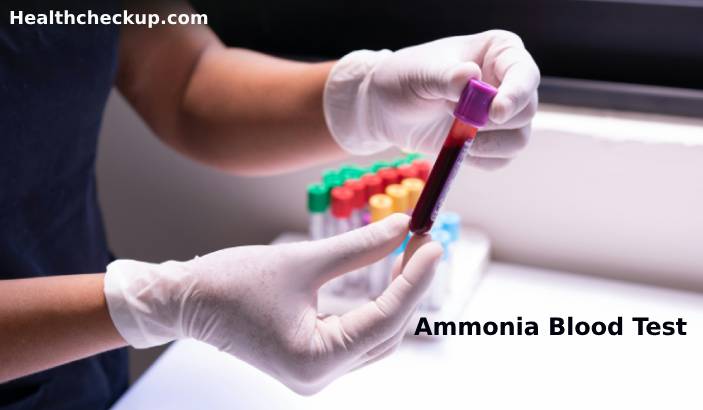 Ammonia Blood Test: Purpose, Preparation, Procedure, Normal Range