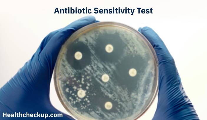 Antibiotic Sensitivity Test: Essential Insights for Effective Treatment