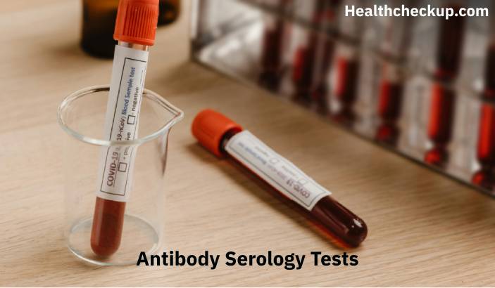 Antibody Serology Tests: Purpose, Procedure, Results