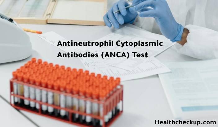 ANCA Test - Purpose, Procedure, Results, Risks