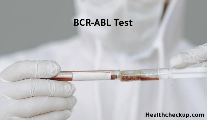 BCR ABL Test: Purpose, Procedure, Results