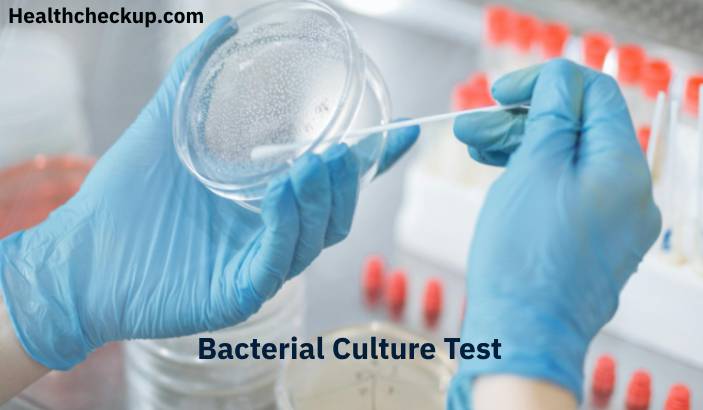 Bacteria Culture Test: Purpose, Procedure, Results, Risks