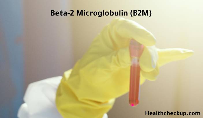 Beta 2 Microglobulin (B2M) Blood Test: Low, High, Normal Levels