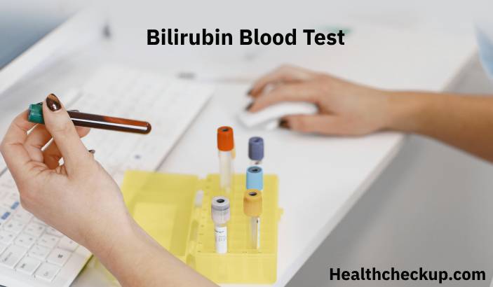 Bilirubin Blood Test: Low, High, Normal Levels