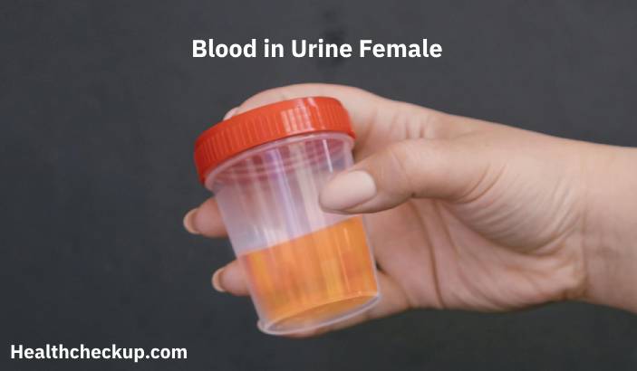 Blood in Urine in Females: Causes, Diagnosis, and Treatment