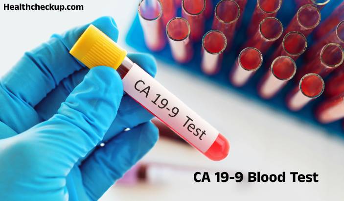 CA 19-9 Blood Test: A Guide to Pancreatic Cancer Diagnosis