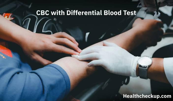 CBC with Differential Blood Test: Purpose, Preparation, Results