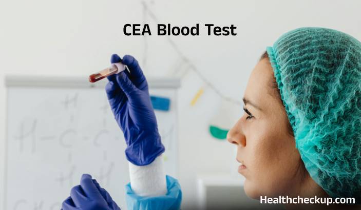 CEA Blood Test: Purpose, Normal Range, and Results
