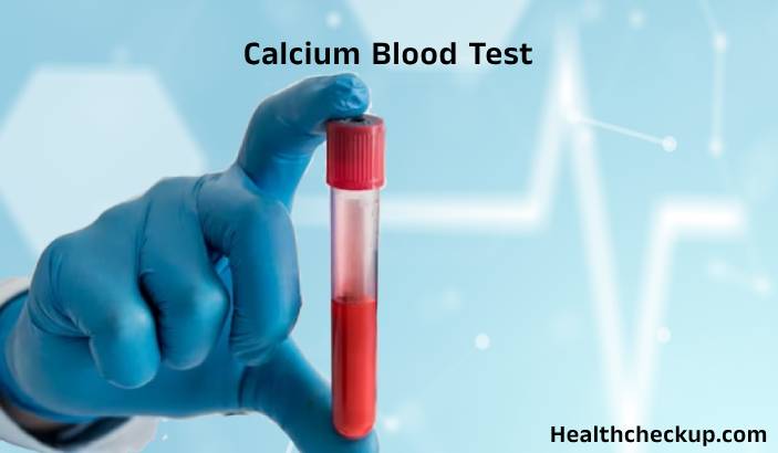 Calcium Blood Test: High, Low, and Normal Levels