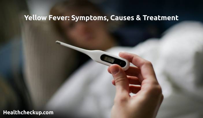 Yellow Fever: Symptoms, Causes & Treatment