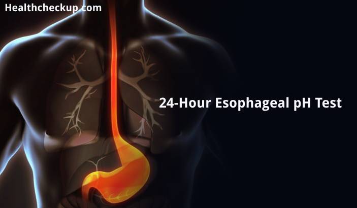 Esophageal pH Test - Purpose, Preparation, Procedure, Results