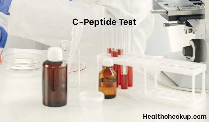 C-Peptide Test - Purpose, Procedure, Results