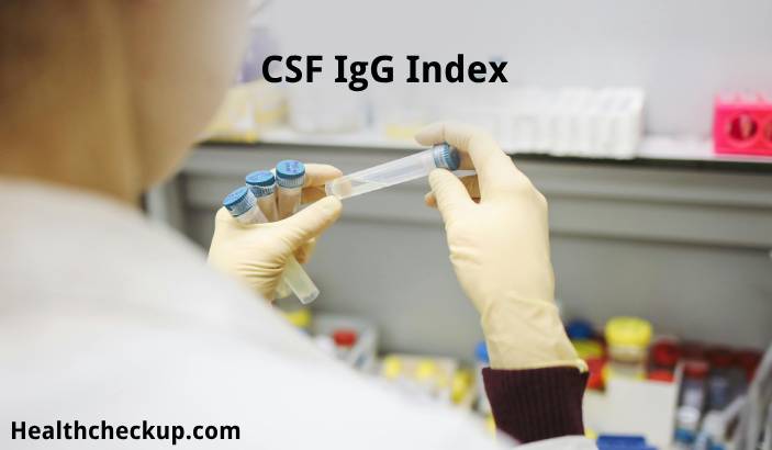 CSF IgG Index - What is it, Purpose, Normal Range, Results
