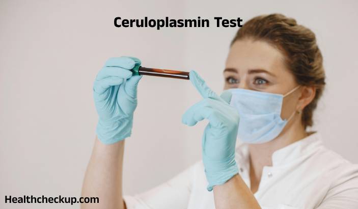 Ceruloplasmin Test: Purpose, Procedure, Normal Range, Results