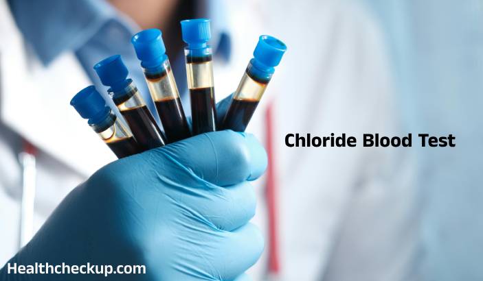 Chloride Blood Test: Low, High, and Normal Levels