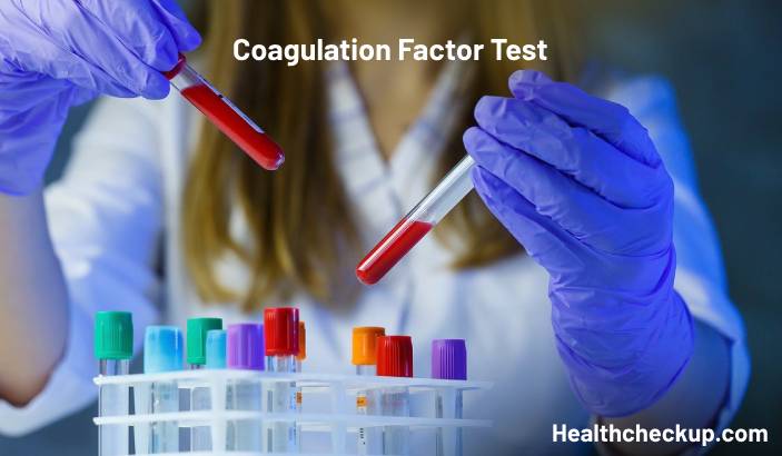 Coagulation Factor Test: Purpose, Preparation, Procedure, Results