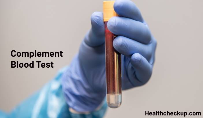 Complement Blood Test: Types, Purpos, Preparation, and Results