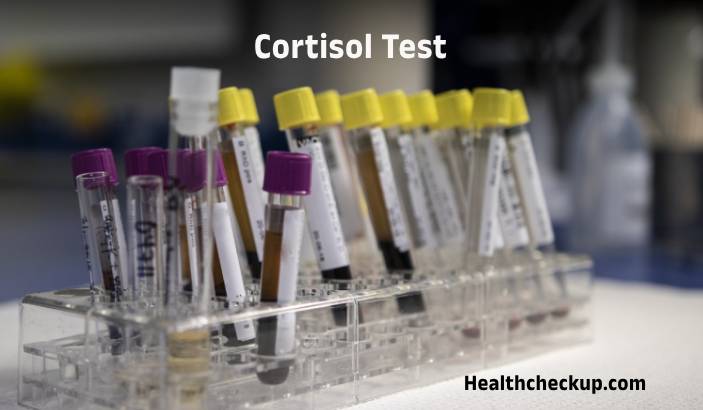 Cortisol Test: Types, Purpose, Preparation, Procedure, Results