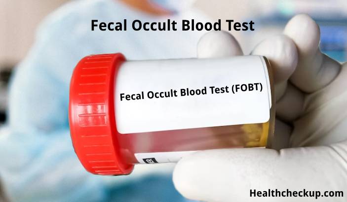 Fecal Occult Blood Test (FOBT): Purpose, Preparation, Procedure, Results
