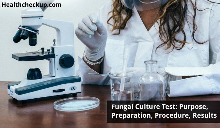Fungal Culture Test: Purpose, Preparation, Procedure, Results
