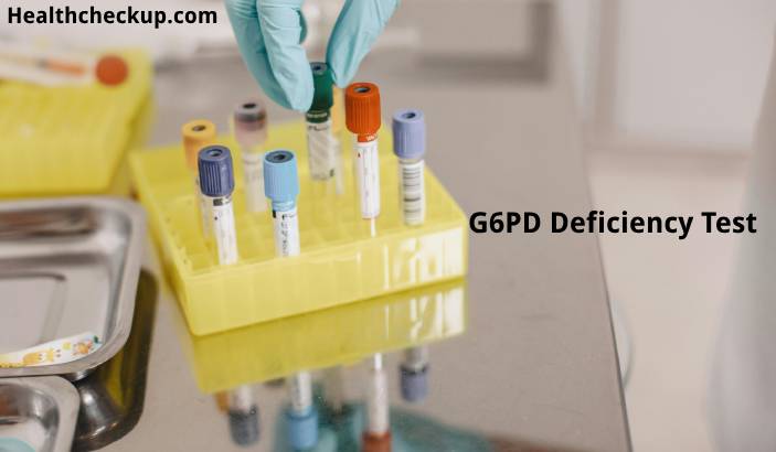 G6PD Test - Purpose, Preparation, Procedure, Normal Range, Results