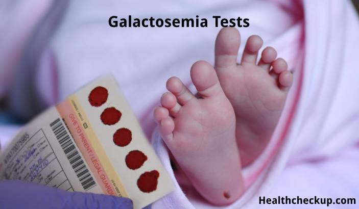 Galactosemia Tests: Purpose, Preparation, Procedure, Normal Range, Results