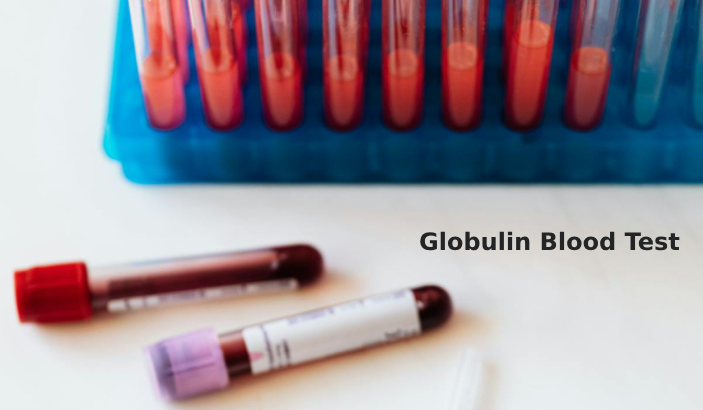 Globulin Test