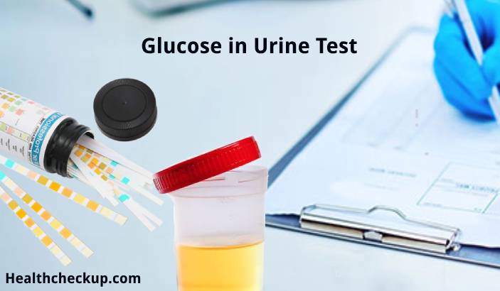 Glucose in Urine - What is it, Purpose, Preparation, Procedure, Results