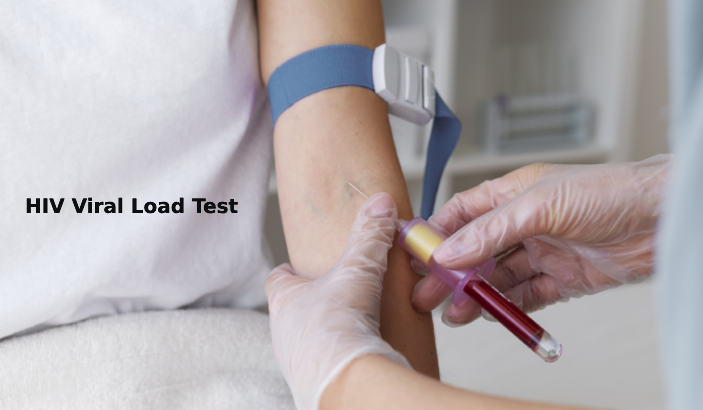 HIV Viral Load Test