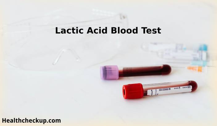 : Lactic Acid Blood Test: Purpose, Preparation, Procedure, Normal Range, Results