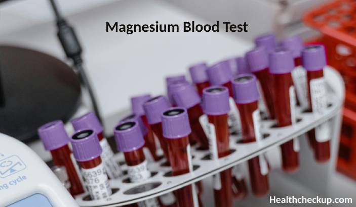 Magnesium Blood Test: Purpose, Preparation, Procedure, Normal Range, Results