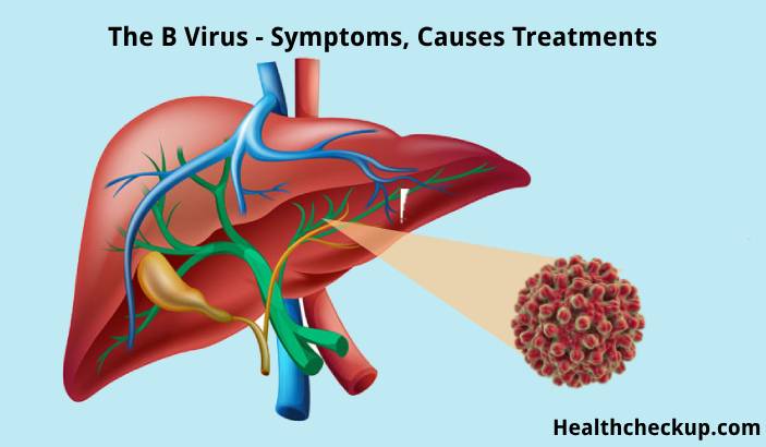 The B Virus - Symptoms, Causes, and Treatments