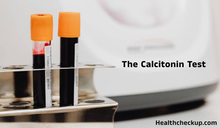 Calcitonin Test: Purpose, Normal Range, and Results